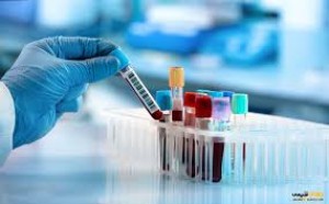 گزارش جامع فعالیت‌های اداره آزمایشگاه کنترل غذا و دارو در طرح سلامت نوروزی ۱۴۰۴